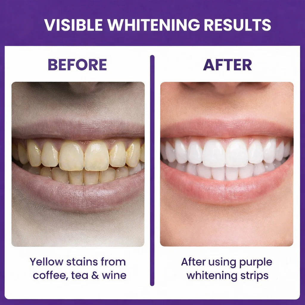 Instant White Strips – 42 Strip Kit