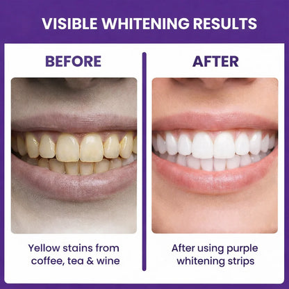 Instant White Strips – 42 Strip Kit
