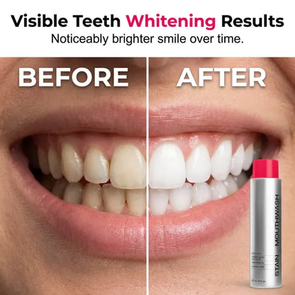Fresh Breath Mouthwash